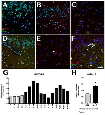 Notch Signalling in the Hippocampus of Patients With Motor Neuron Disease